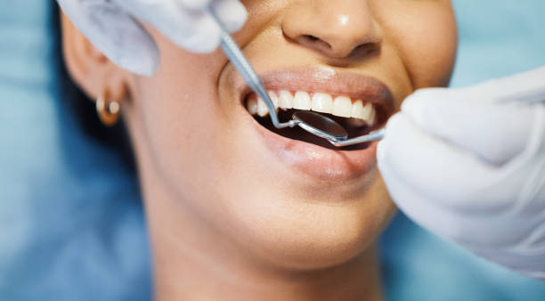 Best Emergency Treatment for Dental Infections or Abscesses in New Egypt, NJ