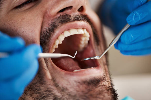 Best Emergency Treatment for Dental Infections or Abscesses in New Egypt, NJ
